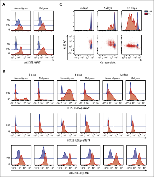 STAT3 phosphorylation, IL-2R subunits expression, and proliferation of primary CTCL (SS) cells in the presence of SE. (A) STAT3 phosphorylation in malignant and nonmalignant T cells from cultured SS PBMC cultures in the presence of SE (ie, cultures of malignant T cells and bystander cells from 2 patients). Data from 5 additional patients are shown in supplemental Figure 4. (B) IL2R-α, IL2R-β, and IL2R-γ expression in primary malignant and nonmalignant T cells from cultured SS PBMCs in the presence of SE after 3, 6, and 12 days as described previously. (C) Proliferation of primary malignant T cells from cultured SS PBMCs in the presence or absence of SE after 3, 6, and 12 days. Data in panels B and C are representative of 2 patients. PBS, phosphate-buffered saline; SE, staphylococcal enterotoxin; US, unstimulated.