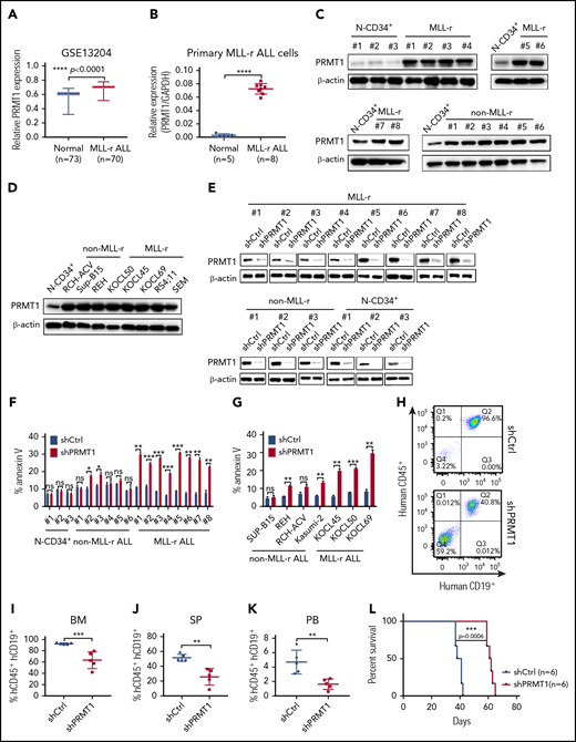 MLL-r ALL cells show increased PRMT1 expression and sensitivity to PRMT1 knockdown. (A) PRMT1 expression (presented on a log scale) in GSE13204 data sets containing specimens from patients with MLL-r ALL vs healthy donors. (B) PRMT1 messenger RNA (mRNA) expression in normal peripheral blood stem cell (PBSC) CD34+ cells (n = 5) and MLL-r ALL primary blasts (n = 8). (C) Western blot showing PRMT1 expression in CD19+ blast cells from primary MLL-r B-ALL (n = 8) and non–MLL-r B-ALL (n = 6) cells compared with normal CD34+ (N-CD34+) cells from PBSC donors (n = 3). (D) Western blot analysis of PRMT1 expression in non–MLL-r (RCH-ACV, Sup-B15, and REH) and MLL-r ALL (KOCL45, KOCL50, KOCL69, RS4;11, and SEM) cell lines compared with that of normal CD34+ cells. (E) Western blot for PRMT1 in primary MLL-r ALL cells, primary non–MLL-r ALL cells, and normal CD34+ cells transduced with a vector expressing shCtrl or shPRMT1. (F) Apoptosis of normal CD34+, primary non–MLL-r, or MLL-r ALL cells, each transduced with shCtrl or shPRMT1, as analyzed by annexin V-Cy5/4′,6-diamidino-2-phenylindole (DAPI) labeling. (G) Apoptosis of shCtrl- or shPRMT1-expressing non–MLL-r ALL or MLL-r ALL cell lines. (H) Shown are representative fluorescence-activated cell sorted profiles for human CD45+/CD19+ cells engrafted in BM from SEM-shCtrl- or SEM-shPRMT1-transplanted mice. Q1: hCD45+CD19−; Q2: hCD45+CD19+; Q3: hCD45−CD19+; Q4: hCD45−CD19−. Percentage of human CD45+/CD19+ (hCD45+/hCD19+) cells engrafted in BM (I), spleen (SP; J), or peripheral blood (PB; K) of recipient NSG mice at 5 weeks after bone marrow transplantation (n = 5 per group). (L) Survival of NSG mice engrafted with SEM cells transduced with either shCtrl or shPRMT1 (n = 6 mice per group). Error bars represent standard error of the mean. *P < .05; **P < .01; ***P < .001; ****P < .0001. GAPDH, glyceraldehyde-3-phosphate dehydrogenase; ns, not significant.