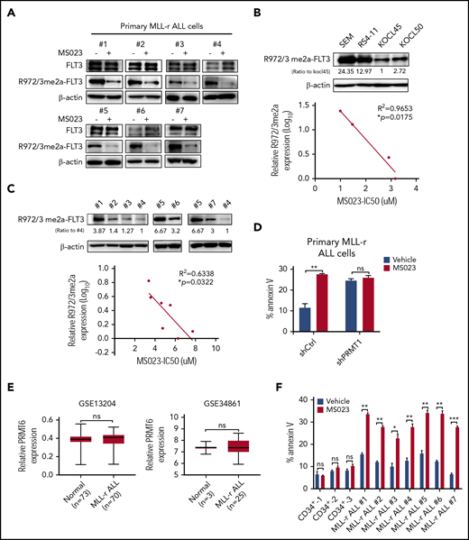 Pharmacologic inhibition of PRMT1 blocks MLL-r ALL cell survival and growth. (A) Western blot for FLT3 and R972/973me2a in MLL-r ALL samples (n = 7) treated with vehicle or MS023 (5 μM). (B-C) Western blot of endogenous R972/3me2a expression in MLL-r ALL cell lines (n = 4) (B, upper panel) and MLL-r ALL samples (n = 7) (C, upper panel). Bottom panels show corresponding correlation analysis of R972/973me2a expression and MS023 IC50 (the half maximal inhibitory concentration). (D) Apoptosis of shCtrl- or shPRMT1-transduced primary MLL-r ALL cells treated with vehicle or MS023. (E) PRMT6 gene expression was analyzed between non–MLL-r and MLL-r ALL specimens in indicated microarray data sets (GSE13204 and GSE34861). (F) Apoptosis of indicated subsets of normal PBSCs (n = 3) in MLL-r ALL samples (n = 7) treated with vehicle or MS023. Error bars represent standard error of the mean. *P < .05; **P < .01; ***P < .001.