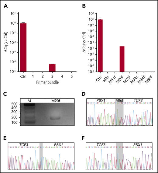 TCF3-PBX1+ GIPFEL results for samples N15 and N141. (A) Result of the first RT-PCR analysis of N15. The amplification of the 5 PBX1 primer bundles (1 through 5) was compared with the amplification of the internal PBX1 wild-type control (Ctrl). Primer bundle 3 leads to a detectable amplification. (B) Amplification plot of the second RT-PCR analysis of N15. The forward primers of bundle 3 were de-multiplexed, and primer PBX1-M20f was identified as the primer responsible for the amplification. (C) Agarose gel analysis of N15 after a PCR assay with PBX1-M20f and the reverse primer TCF3-M1r-n. The PCR data show the expected product of 158 bp. (D) Sanger sequencing result of UCB sample N15. The expected sequences flanking the MfeI ligation joint (gray) were identified, indicating the fusion of PBX1 segment M20 to TCF3 segment M1. (E) Sanger sequencing result of the chromosomal breakpoint of sample N15. Bases on a gray background indicate nontemplate bases. (F) Same as (E), but for sample N141. ΔCq, normalized quantification cycle, with the PBX1 wild-type control set as 1.