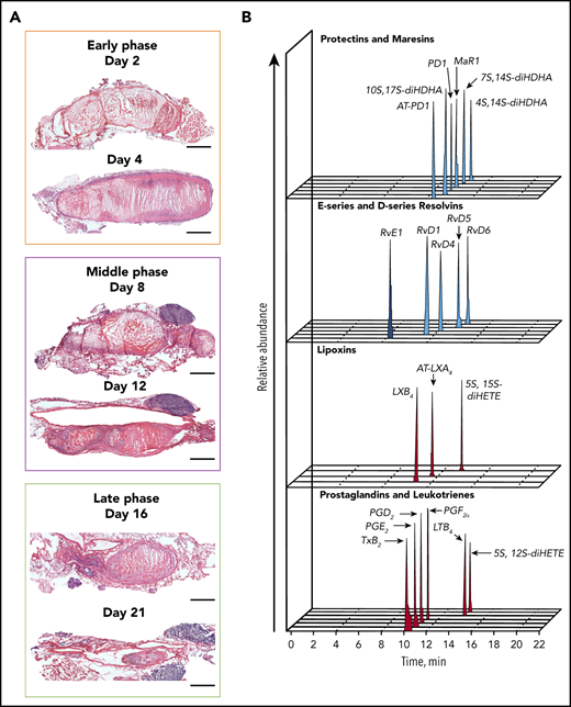 Temporal distribution of LM-SPM in the thrombus during DVT in mice. (A) Naturally occurring VT progression in C57BL/6J WT mice. Hematoxylin and eosin stains of longitudinal mouse venous thrombus sections at days 2, 4, 8, 12, 16, and 21 postinduction. The stenosis site (head of the thrombus) is to the left and the distal end of the thrombus (tail) is to the right on all images. Scale bars, 1 mm. (B) Representative liquid chromatography-tandem mass spectrometry chromatograms of the LMs derived from DHA (blue), from EPA (dark blue), and from AA (red) identified in the thrombus. (C) Tandem mass spectrometry spectra from SPMs identified in the thrombus by characteristic diagnostic ions. (D) Representative principal component analysis score plot (left) and loading plot (right) showing temporal distribution of LMs in the thrombus during DVT. Orange, early (acute) phase (6 hours, day 2, and day 4); purple, middle (subacute) phase (day 6 and day 8); green, late (chronic) phase (day 14) after induction of DVT in WT mice. Data in panels B, C, and D are representative of a pool of 3 thrombi.