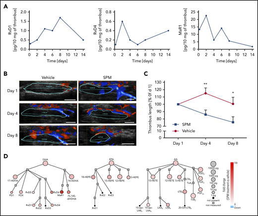Treatment with RvD1, RvD4, LXA4, and MaR1 enhances thrombus resolution in mice. (A) Temporal distribution of RvD1, RvD4, and MaR1 in the thrombus during DVT in mice. Results are expressed in picograms of SPM/10 mg of thrombus and are representative of a pool of 3 thrombi. (B) Representative Doppler ultrasonography images of IVC thrombi obtained from the same mouse at the indicated points after IVC stenosis induction. The red represents arterial flow, the blue is venous flow, and the thrombus is outlined in cyan. Scale bars, 2.5 mm. (C) Relative thrombus length. Thrombus size was monitored by ultrasonography on day 1, day 4, and day 8 postsurgery. n = 7 mice in the vehicle-treated group (●), and n = 9 in the SPM mix-treated group (▪). *P < .05; **P < .01, with 2-tailed unpaired t test for vehicle vs SPM. (D) Network pathway visualization of the LMs in the thrombus after SPM treatment. Node size represents the amount of LM (pg/10 mg of thrombus) in the thrombus after SPM treatment. Node color represents the fold change (compared with vehicle treatment).