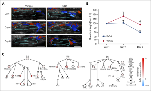 RvD4 treatment enhances thrombus resolution in mice. (A) Representative Doppler ultrasonography images of IVC thrombi obtained from the same mouse at the indicated time points after IVC stenosis induction. The red represents arterial flow, the blue is venous flow, and the thrombus is outlined in cyan. Scale bars, 2.5 mm. (B) Thrombus size was monitored by ultrasonography on day 1, day 4, and day 8 postsurgery. n = 5 mice in the vehicle-treated group (●), and n = 8 in the RvD4-treated group (▪). *P < .05, with 2-tailed unpaired t test for vehicle vs RvD4. (C) Network pathway visualization of the LMs in the thrombus after RvD4 treatment. Node size represents the amount of LMs (pg/10 mg of thrombus) in the thrombus after RvD4 treatment. Node color represents the fold change (compared with vehicle treatment).