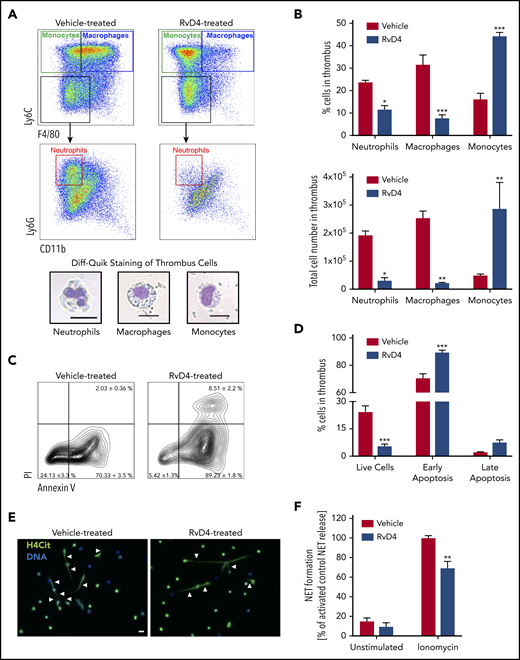 RvD4 decreases neutrophil and macrophage recruitment in the thrombus and inhibits NETosis. (A, top) Flow cytometry strategy gated on CD45+ leukocytes isolated from mouse thrombi (8 days after IVC stenosis). Monocytes (CD45+Ly6C+F4/80−), macrophages (CD45+Ly6C+F4/80+), and neutrophils (CD45+Ly6GhighLy6C−F4/80−) were identified in the thrombus (8 days after IVC stenosis). (Bottom) Diff-Quik staining of neutrophils, macrophages, and monocytes from mouse thrombus. Scale bar, 20 μm, ×40. (B, top) Percentage of neutrophils, macrophages, and monocytes obtained by flow cytometry in the thrombus 8 days after IVC stenosis of mice treated with vehicle or RvD4. (Bottom) Total neutrophil, macrophage, and monocyte counts in the thrombus. (C) Cell viability in the thrombus 8 days after IVC stenosis was measured using propidium iodide (PI) and annexin V staining. (D) Percentage of live cells (Annexin V−PI−), cells in early apoptosis (Annexin V+PI−), and cells in late apoptosis (Annexin V+PI+) in mouse thrombus (8 days after IVC stenosis) after treatment with vehicle or RvD4. (E-F) Neutrophils were isolated from peripheral blood of vehicle-treated or RvD4-treated mice 24 hours after treatment and kept unstimulated, or were stimulated with ionomycin for 4 hours. (E) Representative fluorescence microscopy images of ionomycin-treated neutrophils illustrating H4Cit+ neutrophils releasing NETs (white arrowheads). H4Cit, green; DNA, blue. (F) Quantification of the percentage of NET-releasing cells. n = 6. Scale bar, 20 µm. *P < .05; **P < .01; ***P < .001 with 2-tailed unpaired t test for comparison of vehicle to RvD4.