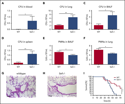 L-selectin is required for host defense during K pneumoniae–induced pneumonia. (A-I) WT and Sell−/− mice were subjected to K pneumoniae intratracheal injection. Bacterial burden in terms of CFU in blood (A), lung (B), BALF (C), and spleen (D), as well as neutrophil recruitment into the alveoli (E) and lung tissue (F), were determined 24 hours after Kpneumoniae injection. Representative hematoxylin and eosin staining of the lung of WT (G) and Sell−/− (H) mice 24 h after intratracheal instillation with K pneumoniae (scale bars, 50 µm). (I) Survival of WT and Sell−/− mice after K pneumoniae intratracheal injection. n = 8 mice per genotype. Data are mean ± standard error of the mean. *P = .05, **P = .01, Student t test and log-rank (Mantel-Cox) test.