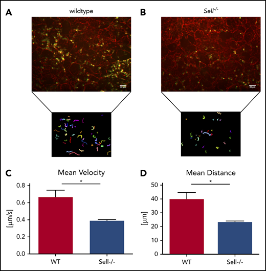 Neutrophil migration in a mouse model of pneumonia is L-selectin–dependent. (A-D) WT and Sell-/- mice were injected intratracheally with Kpneumoniae. (A-B) Representative confocal images and neutrophil migratory tracks in agarose-filled lung slices of wildtype (A) and Sell−/− (B) mice over a 60 minute timeframe 4 hours after intratracheal instillation of Kpneumoniae. The CellObserver SD (Zeiss, Göttingen, Germany) equipped with a 20 ×/1.0 NA objective was used, white scale bars represent 30 µm. Neutrophil migration velocity (C) and distance (D). n = at least 3 mice/genotype, mean ± standard error of the mean, rank-sum test *P = .05.