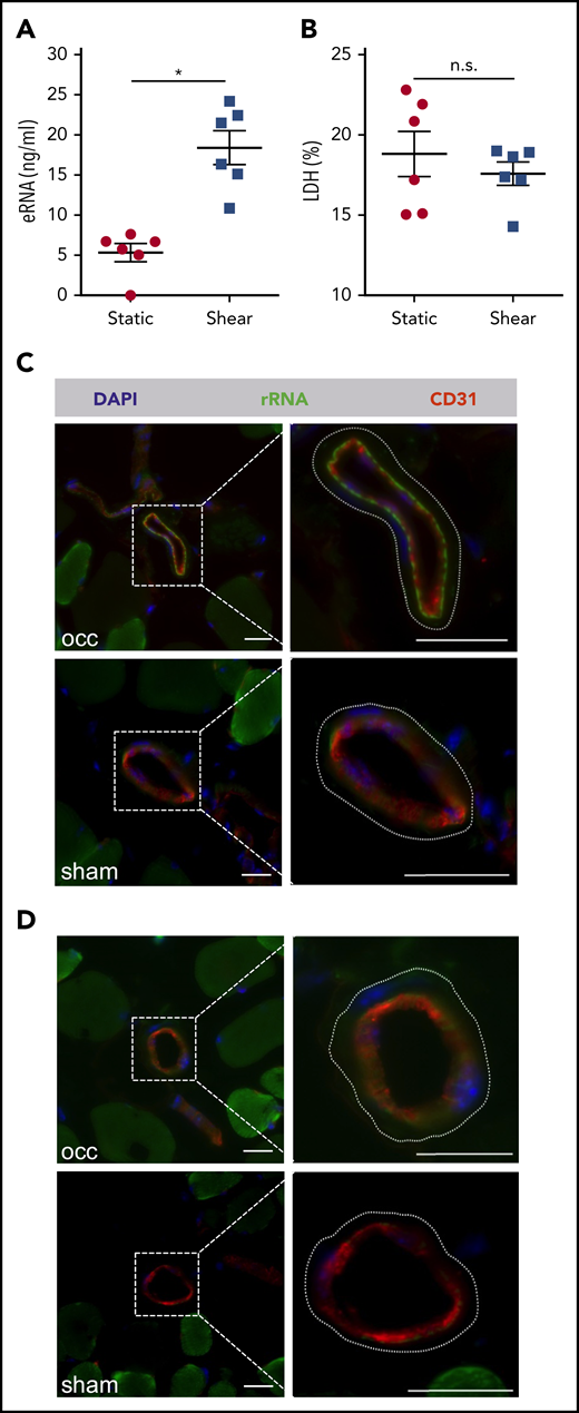 In vitro and in vivo analysis of eRNA release. (A) eRNA levels were measured in supernatant of BAECs, with or without shear conditions of 12 dyn/cm2 for 60 minutes. (B) The levels of LDH (expressed as percentage of total) were measured in the same supernatants of the BAECs, exposed to shear or under static conditions. Data are mean ± SEM; n = 6 per group. (C-D) Representative fluorescent immunohistological pictures of collaterals of mice 30 minutes after induction of arteriogenesis (occ) or sham operation. To visualize collaterals, tissue samples were stained with an antibody against CD31 (red) depicting ECs. Nuclei were counterstained with 4′,6-diamidino-2-phenylindole. The dashed lines in the magnified images (right panels) delineate the outer border of the vessels of the smooth muscle cells. A specific signal for the IV applied fluorescently labeled antibody against ribosomal RNA (green) was found at the abluminal side of ECs of growing collaterals (occ, upper panel), but not of resting collaterals (sham, lower panel) (C), or control mice (D). Scale bars, 20 μm. *P < .05, unpaired Student t test. n.s., not significant.