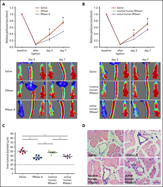 RNase treatment decreases perfusion recovery and vessel growth. (A-B) Laser Doppler perfusion measurements (upper panels) and corresponding flux images (lower panels) of mice treated as indicated. The perfusion was calculated using occluded/sham (right to left) ratios before the surgical procedure, immediately after the surgical procedure, and at days 3 and 7 after surgery (n = 6). Representative flux images are shown for days 3 and 7. (C) The dot plots show the inner luminal diameter of mice treated with saline, RNase A, or recombinant inactive or active human RNase1 7 days after the surgical procedure (n = 6 per group). Data are mean ± SEM. The dashed horizontal line indicates the mean sham value. (D) Representative photomicrographs of Giemsa-stained tissue samples. Scale bars, 20 µm. *,#P < .05; *saline vs RNase A, #DNase vs RNase A, *saline vs active human RNase1, #inactive human RNase1 vs active human RNase1, 2-way analysis of variance (ANOVA) with the Bonferroni multiple-comparison test (A-B) and 1-way ANOVA with the Bonferroni multiple-comparison test (C).