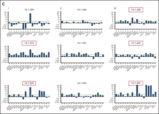 Activated fibroblasts are common in primary samples from patients with de novo ALL who are undergoing induction chemotherapy. (A) Cytokines and chemokines secreted by MSCs isolated from the normal healthy donor bone marrow or primary patient ALL specimens at diagnosis and after the first and second courses of chemotherapy. IL8 (blue), CCL2 (red), CXCL1 (green), CXCL2 (purple), and IL6 (orange), all in picograms per milliliter, are shown on the y-axis. The x-axis shows each sample denoted by UKALL14 trial patient number (UPN) or healthy donor number (HDN). Arrows below the x-axis indicate the specimens that were subsequently evaluated in more detail. (B) Photomicrographs (original magnification ×40), showing phalloidin and DAPI staining of MSCs isolated from primary patient ALL samples indicated by UPN or HDN. (C) Gene expression profile showing fold upregulation (y-axis) of 18 selected genes in primary patient MSCs (UPN indicated above the panel) at diagnosis (i) and after the first (ii) and second (iii) courses of chemotherapy, compared with the mean baseline of 3 normal healthy donor MSCs, isolated from patients with primary ALL. Red box around UPN indicates specimen with morphological changes. Gene names are shown on the x-axis. A blue line is drawn at twofold upregulation, which is considered significant.