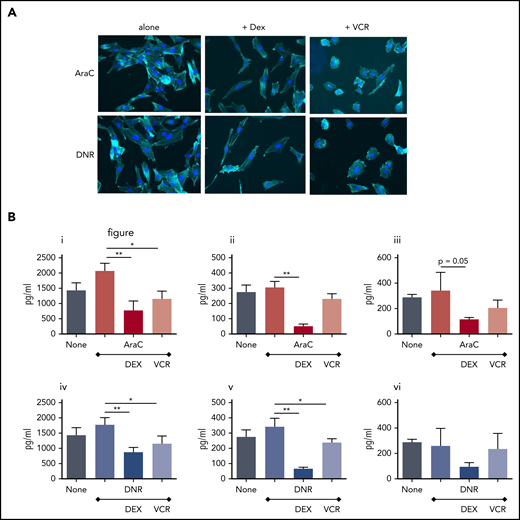 Combining VCR or Dex with AraC or DNR prevents HS27a MSCs from developing the characteristic pathology and cytokine secretion patterns of CAF. (A) Phalloidin/DAPI staining of AraC or DNR-treated HS27a cells, either alone or with VCR or DEX (original magnification ×20). (B) Cytokines and chemokines IL8 (i,iv), IL6 (ii,v), and CCL2 (iii,vi) secreted by HS27a after AraC (i-iii) or DNR (iv-vi) treatment, alone or with DEX or VCR. All statistically significant comparisons (by unpaired Student t test) are as depicted: IL8 AraC vs AraC+DEX, P = .0049; AraC vs AraC+VCR, P = .0112; IL6 AraC vs AraC+DEX, P = .0005; CCL2 AraC vs AraC+DEX, P = .05; IL8 DNR vs DNR+DEX, P = .0053; DNR vs DNR+VCR, P = .0364; IL6 DNR vs DNR+DEX, P = .0011; and DNR vs DNR+VCR, P = .04. *.01 < P ≤ .05; **.001 < P ≤ .01.