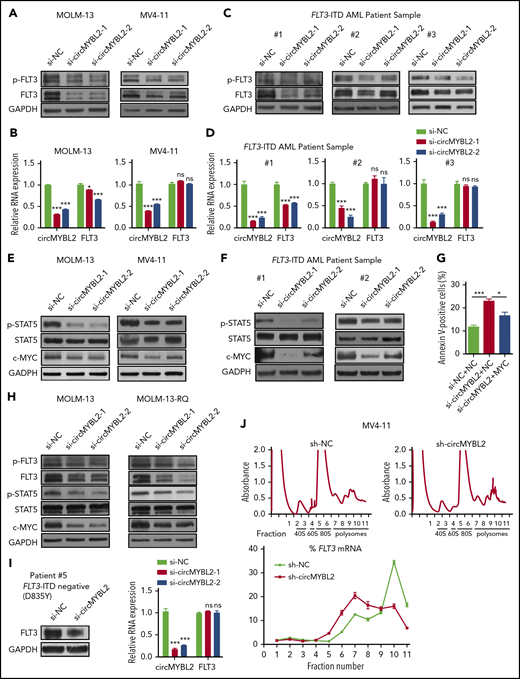 circMYBL2 regulates FLT3-ITD–dependent signaling pathways by modulating the translation of mutant FLT3 kinase. (A) Western blot showing downregulation of FLT3 protein expression upon circMYBL2 knockdown in MOLM-13 and MV4-11 cells. (B) qPCR measuring the expression of FLT3 mRNA upon circMYBL2 knockdown in MOLM-13 and MV4-11 cells. (C) Downregulation of FLT3 protein expression upon circMYBL2 knockdown in FLT3-ITD AML patient samples. (D) qPCR measuring the expression of FLT3 mRNA upon circMYBL2 knockdown in FLT3-ITD AML patient samples. (E-F) Western blot showing the downregulation of STAT5 signaling activation upon circMYBL2 knockdown in MOLM-13 and MV4-11 cells and in AML patient samples. (G) Flow cytometric analysis of apoptosis in MV4-11 cells upon circMYBL2 knockdown or c-MYC overexpression. The numbers indicate the percentages of cells. (H) Western blot showing the decrease in FLT3 protein, p-STAT5, and c-MYC levels upon circMYBL2 knockdown in MOLM-13 and MOLM-13-RQ cells. (I) circMYBL2 knockdown reduced the levels of FLT3 kinase harboring the D835Y mutation in an AML patient sample. (J) Polysomes in cytoplasmic extracts of sh-NC and sh-circMYBL2 MV4-11 cells were fractionated through sucrose gradients, and the relative levels of FLT3 mRNA were analyzed by qRT-PCR in the gradient fractions. ns, not significant.