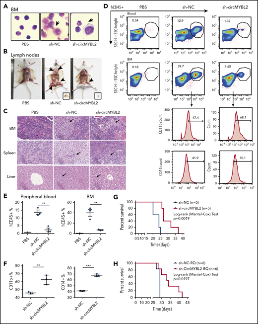 circMYBL2 knockdown impairs the tumorigenesis and infiltration of FLT3-ITD AML cells in vivo. (A) Wright-Giemsa staining of BM samples isolated from mice engrafted with human MOLM-13 cells cotransfected with sh-NC and sh-circMYBL2. hCD45+ cells in the mice are indicated by the black arrows. Original magnification ×400. (B) Representative images of lymph nodes from control and sh-circMYBL2-MOLM-13–treated mice. Reduced lymph node involvement in sh-circMYBL2-MOLM-13–treated mice compared with sh-NC-MOLM-13–treated control mice. (C) H&E staining showing infiltration of leukemic cells in the BM, spleen, and liver of mice engrafted with sh-circMYBL2 cells compared with that in control mice. hCD45+ cells in the tissues are indicated by the black arrows. (D) Flow cytometry showing substantially decreased levels of blasts in blood and BM samples from mice treated with circMYBL2-knockdown MOLM-13 cells relative to these levels in control mice. CD11b and CD14 marker expression was dramatically increased in sh-circMYBL2-MOLM-13–treated mice compared with that in sh-NC-MOLM-13–treated mice. (E-F) Scatter plots show the statistical values for panel D. (G) Kaplan-Meier survival curves for mice implanted with sh-NC or sh-circMYBL2 MOLM-13 cells (n = 5 mice per group). P values were calculated using a log-rank (Mantel-Cox) test. (H) Kaplan-Meier survival curves for mice implanted with sh-NC or sh-circMYBL2 MOLM-13-RQ cells (n = 6 mice per group). P values were calculated using a log-rank (Mantel-Cox) test. SSC, side scatter.