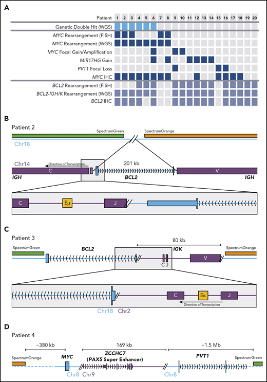 FISH-cryptic MYC and BCL2 rearrangements identified by WGS in DHITsig+ DLBCL tumors. (A) Diagram summarizing the occurrence of each genetic event identified in the 20 non–HGBL-DH/TH-BCL2 DHITsig+ genomes. The thresholds for MYC and BCL2 immunohistochemistry (IHC) positivity were 40% and 50%, respectively. (B-C) Cryptic BCL2 translocations identified in tumors that were negative for BCL2 rearrangement by breakapart FISH. (D) A cryptic MYC rearrangement identified in a tumor that was negative for MYC rearrangement by breakapart FISH.
