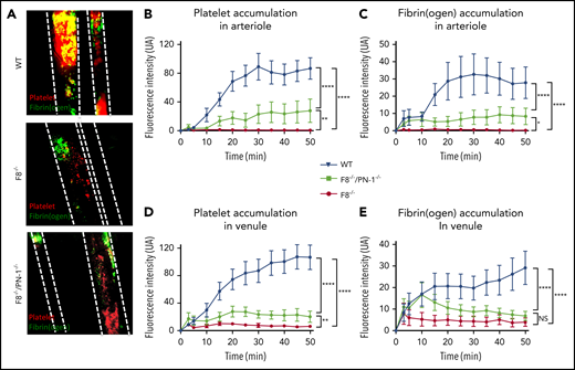 PN-1 deficiency effect in mice with an F8 deficiency during the mesenteric vessel ferric chloride-induced injury model. Quantitative analysis of platelet accumulation and fibrin generation after deposit of FeCl3 to mesenteric vessels. Mice were injected with Alexa 647-labeled antibodies against glycoprotein IX and with AF488-labeled fibrinogen to monitor platelet accumulation and fibrin generation respectively. Representative images obtained 30 min after the start of recording (A). Platelet (B,D) and fibrin accumulation (C,E) in arterioles (B-C) and in venules (D-E). The mean of fluorescence intensity ± SEM is shown (n = 10-12). A 2-way ANOVA test followed by a multiple comparison test was used. *P < .05; **P < .01; ***P < .001; ****P < .0001.