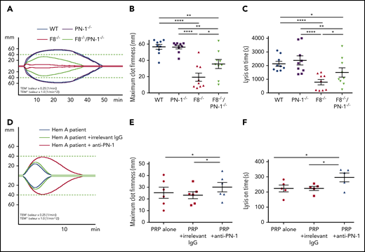 PN-1 deficiency in mice with F8 deficiency or PN-1 blocking in blood of hemophilia A patients improves clot stability and limits clot lysis. Representative whole blood thromboelastogram (ROTEM) profiles for hemophilic mice (A) or a patient with hemophilia (D). The maximum clot firmness corresponds to the maximum amplitude reached during the test (B,E), and the lysis on time corresponds to the time span from clotting time to the start of significant lysis (C,F). Each dot represents 1 mouse (B-C) or 1 patient (E-F). Values are means ± SEM. A 2-way ANOVA followed by a multiple comparison test was used. *P < .05; **P < .01; ****P < .0001.