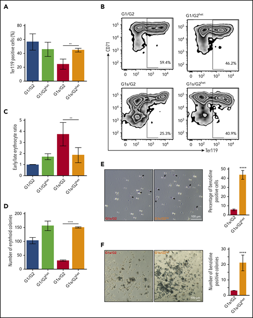 Haploinsufficiency of Gata2 improves erythropoiesis in Gata1s embryos. (A) Bar graph depicts the mean percentage of Ter119 expressing fetal liver cells from Gata1/Gata2 (G1/G2), Gata1/Gata2het (G1/G2het), Gata1s/Gata2 (G1s/G2), and Gata1s/Gata2het (G1s/G2het) embryos. (N > 3). (B) Representative flow cytometry plots of CD71/Ter119 erythroid staining of fetal liver cells isolated from male embryos of each genetic background. (C) Bar graph depicting the mean ratio of early erythroblasts (Ter119+/CD71+) vs late differentiated erythroid cells (Ter119+/CD71−) in panel B. (D) E12.5 fetal liver cells were isolated and cultured in methylcellulose medium supplemented with EPO to support erythroid colony formation. Bar graph represents the number of BFU-E of each of the genotypes. Mean ± SD are shown (N = 3). (E) Representative images of fetal liver erythroid cells after benzidine staining. Arrows indicate dark stained hemoglobin-containing cells. Bar graph represents mean number of benzidine stained cells out of the total fetal liver cells counted for each genotype. (F) Representative images of colonies from G1s/G2 and G1s/G2het. A total of 5000 E12.5 fetal liver cells were cultured in methylcellulose supplemented with EPO and colonies were stained with benzidine. Dark staining indicates hemoglobin-containing colonies. Bar graph depicts mean number of benzidine-stained colonies from each genotype. **P ≤ .01, ****P ≤ .0001 (unpaired Student t test). Original magnification ×10 (E) and ×4 (F).
