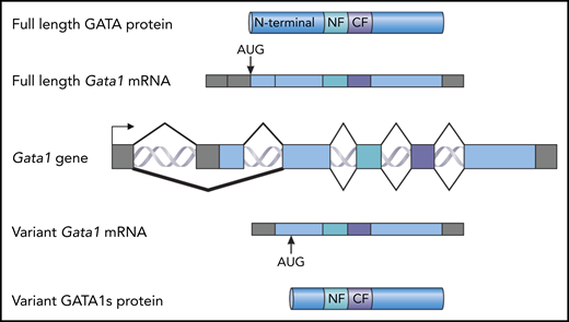 Full-length forms and short forms of the GATA1 protein. A map of the Gata1 locus is shown in the center (Gata1 gene). The exons are shown as blocks. Gray indicates noncoding sequence; blue indicates coding sequence. Above the gene, a spliced, full-length Gata1 messenger RNA (mRNA) is shown with the AUG initiation codon indicated. This RNA is translated into full-length GATA1 protein (top). The N-terminal domain, the N-terminal zinc finger (NF), and the C-terminal zinc finger (CF) are indicated. Below the gene, a spliced variant Gata1 mRNA encoding the variant GATA1s protein is shown, with the alternative GATA1s AUG initiation codon indicated. This RNA is translated as the GATA1s protein. The N-terminal zinc finger and the C-terminal zinc finger are indicated.