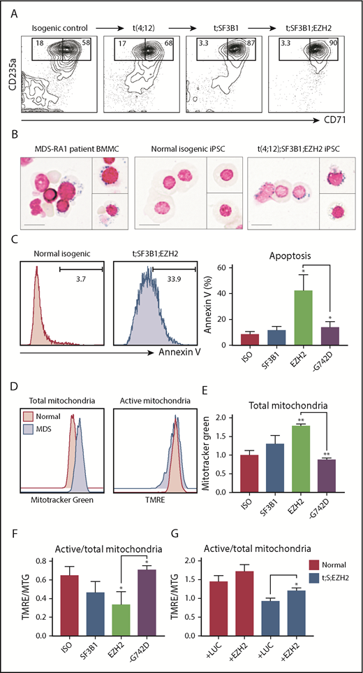 Figure 3. SF3B1 mutations perturb mitochondrial function. For all panels, isogenic iPSCs are abbreviated: normal (ISO), t(4;12);SF3B1 (t;SF3B1 or SF3B1), t(4;12);SF3B1;EZH2 (t;SF3B1;EZH2 or EZH2), and SF3B1 G742D-ablated (-G742D). (A) Erythroid differentiation of CD34-5F cells derived from MDS-RA1 patient iPSCs. Percentage of early (CD71+CD235a+) and mature (CD71loCD235a+) erythroblasts, day 11 of differentiation. (B) Prussian blue iron staining of primary BMMCs from patient MDS-RA1 and erythroblasts from normal isogenic or t;SF3B1;EZH2 MDS-iPSCs. Ring sideroblasts were evaluated based on the criteria of >5 iron granules encircling at least one-third of the circumference of the nucleus. Scale bars 15 μm. (C) Frequency of annexin V+ apoptotic CD235a+ erythroid cells derived from isogenic iPSCs. (D) Total and active mitochondrial content in CD235a+ erythroid cells derived from isogenic iPSCs. (E) Total mitochondrial content measured as mean fluorescence intensity (MFI) of MTG in CD235a+ erythroid cells derived from isogenic iPSCs. (F) Ratio of active (measured as MFI of TMRE) to total (measured as MFI of MTG) mitochondria in CD235a+ cells derived from isogenic iPSCs. (G) Ratio of active to total mitochondria in normal (ISO) and t;SF3B1;EZH2 CD235a+ cells transduced with a control luciferase (+LUC) or EZH2 overexpression lentivirus (+EZH2). (C-G) Mean ± standard deviation of 3 experiments, 1 to 2 iPSCs per genotype. **P < .01, *P < .05, t test vs ISO unless indicated.