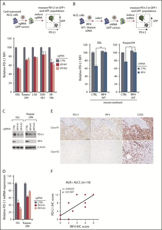 Figure 2. IRF4 regulates PD-L1 expression in ALK+ ALCL. (A) ALCL lines were transduced with IRF4 or Ctrl sgRNAs along with the green fluorescent protein (GFP). Surface PD-L1 expression in transduced (GFP+) cells and sgRNA un-transduced (GFP−) cells were measured by flow cytometry. The relative PD-L1 MFI was normalized to the un-transduced (GFP−) cells. Number of repeats: DEL, n = 10; Karpas299, n = 10; SR786, n = 5; L-82, n = 4; and SUDHL1, n = 4). Error bars denote standard error of the mean (SEM). P < .05 for all the data. (B) DEL and Karpas 299 cells transduced with WT IRF4 or with a control vector, were induced to express control or IRF4 shRNAs along with GFP. Surface PD-L1 expression in uninfected (GFP−) cells and shRNA-infected (GFP+) cells were measured by flow cytometry. The relative PD-L1 MFI was normalized to the uninfected (GFP−) cells. Error bars denote SEM of 4 repeats. **P < .01; *P < .05. (C) ALCL lines were infected with IRF4 or Ctrl sgRNAs, selected and expression induced. Lysates were analyzed by immunoblotting for the indicated proteins. (D) ALCL lines were infected with IRF4 or Ctrl sgRNAs, selected and expression induced, PD-L1 gene expression was measured by real-time PCR. Error bars denote SEM of triplicates. (E) Expression of PD-L1, IRF4, and CD30 in ALK+ ALCL primary cases by IHC. Immunohistochemical PD-L1, IRF4, and CD30 staining are shown in 2 cases. Section of lymph nodes were examined microscopically, using a 200× magnification. The depicted images are representative for the 14 ALK+ ALCL cases examined. (F) Correlation between PD-L1 IHC scores with IRF4 IHC scores, calculated by Spearman's rank correlation methods, in 14 ALK+ ALCL cases.