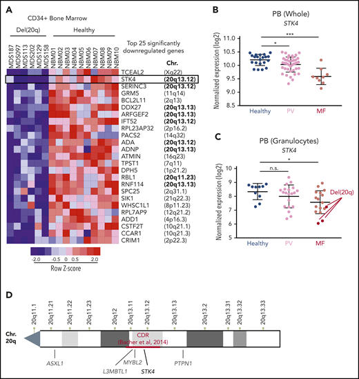 Hippo kinase STK4 is located in the 20q CDR and downregulated in MDS and MPN patients with del(20q). (A) Row-normalized heatmap of gene expression in CD34+ bone marrow cells from 6 del(20q) MDS patients (left) compared with CD34+ bone marrow cells from 10 healthy controls (right). The top 25 significantly downregulated genes in del(20q) patients, along with their chromosomal position in the genome are depicted. Data are from GEO accession number GSE58831. (B) STK4 gene expression measured by microarray in total peripheral blood from healthy controls (blue) and MPN patients with polycythemia vera (PV, pink) or primary MF (red). Data are from GEO accession number GSE26049. (C) STK4 gene expression measured by microarray in peripheral blood granulocytes from healthy controls (blue) and MPN patients with polycythemia vera (PV, pink) or MF (red). Samples identified as del(20q) are indicated. Data are from GEO accession number GSE54646. (D) An NCBI chromosome ideogram showing the q arm of chromosome 20. Minimal CDR measured by array comparative genomic hybridization in a cohort of 30 MDS patients16 is indicated in red. Positions of genes previously implicated in the pathogenesis of myeloid malignancies are indicated in gray. The position of STK4 is indicated in black. Statistical significance was determined by a 2-tailed Student t test. *P < .05, ***P < .001. n.s., not significant. Data in panel A are from Gerstung et al,37 data in panel B are from Skov et al38 and data in panel C are from Rampal et al.39