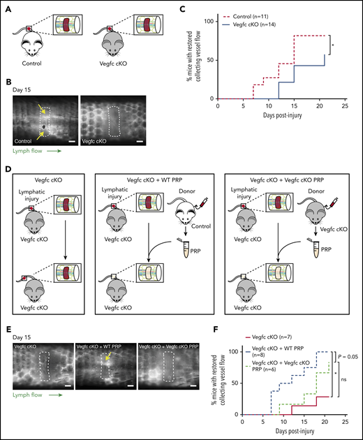 Platelet-derived VEGFC promotes lymphangiogenesis after wounding. (A) Schematic of the hemostatic tail lymphatic injury model comparing control (Vegfcfl/fl) and Vegfc cKO (Vegfcfl/fl; Rosa-creERT2) mice. (B) Representative images of tail lymphangiograms across the injury site on day 15 after tail injury in control and Vegfc cKO animals. Yellow arrows indicate restored collecting vessel flow. (C) Healing curves for restoration of lymphatic flow in control (Vegfcfl/fl) and Vegfc cKO (Vegfcfl/fl; Rosa-creERT2) mice. (D) Schematic of the hemostatic tail lymphatic injury model to assess lymphangiogenic repair in Vegfc cKO mice, Vegfc cKO mice with addition of wild-type PRP and Vegfc cKO mice with the addition of Vegfc KO PRP. (E) Representative images of tail lymphangiograms across the injury site on day 15 after tail injury in Vegfc cKO mice, Vegfc cKO mice with addition of WT PRP and Vegfc cKO mice with addition of Vegfc KO PRP. Yellow arrow indicates restored collecting vessel flow. (F) Healing curves for Vegfc cKO mouse tail lymphatic collecting vessels in Vegfc cKO mice, and Vegfc cKO mice with addition of WT or Vegfc cKO PRP to the injury site. Scale bars = 500 µm. *P < .017 (using the Bonferroni method to correct for multiple comparisons).