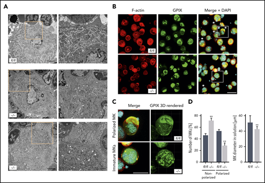 Pdk1-deficient BM MKs show an abnormal ultrastructure with disrupted DMS and abrogated MK polarization. (A) Representative TEM images of Pdk1fl/fl (upper) and Pdk1−/− (lower) MKs in the BM showing decreased presence of demarcation membranes and large granula-free zones upon Pdk1 deficiency. Overview (left; scale bar equals 3 μm). Detail (right; scale bar equals 1 μm). Boxes mark the section in the illustrations which are highlighted in a higher magnification in the right panels. (B) Representative confocal images (maximum projection) of BM-derived Pdk1fl/fl and Pdk1−/− MKs cultured in vitro for 5 days and stained for F-actin (Phalloidin-Atto647N, red), nuclei (DAPI, blue), and GPIX (GPIX-Alexa488, green). Three-dimensional surface rendering of respective z-stacks (right; Imaris 9.2). White asterisks indicate polarized MKs. Scale bar equals 40 μm. Boxes mark the section in the illustrations which are highlighted in a higher magnification in panel C. (C) Detailed visualization of DMS polarization of individual cultured Pdk1fl/fl and Pdk1−/− BM MKs. (D) Quantification of the percent of polarized and nonpolarized Pdk1fl/fl and Pdk1−/− BM MKs (left) and the MK diameter (right). Arithmetic means ± SD (n = 6 mice, at least 100 MKs per genotype were analyzed, unpaired 2-tailed Student t test). **P < .01 indicates statistically significant difference.