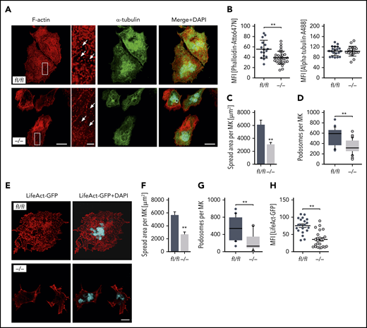 MK-specific deletion of Pdk1 results in defective actin polymerization with disrupted F-actin assembly, impaired spreading, as well as reduced podosome number and morphology upon adhesion on collagen. (A) Representative confocal images (maximum projection) of BM-derived Pdk1fl/fl and Pdk1−/− MKs adherent to collagen (50 μg/mL) and stained for F-actin and α-tubulin displaying a disrupted F-actin organization in the cytoskeleton of Pdk1−/− MKs with impaired spreading and a significant reduction of podosome density. Phalloidin-Atto647N staining was used for F-actin (red); α-tubulin-A488 staining was used for α-tubulin (green), and DAPI was used for nuclei staining (blue). White arrows indicate podosomes. Scale bar equals 40 μm (overview) or 10 μm (detail). (B) Arithmetic means ± SD (left; n = 36 to 59, Wilcoxon-Mann-Whitney test) of F-actin expression (reflected by MFI of Phalloidin-Atto647N) in Pdk1fl/fl and Pdk1−/− MKs upon adhesion to collagen for 3 hours.Arithmetic means ± SD (right; n = 40 to 48, Wilcoxon-Mann-Whitney test) of α-tubulin expression (reflected by MFI of anti–α-tubulin-Alexa488 antibody) in Pdk1fl/fl and Pdk1−/− MKs. (C) Arithmetic means ± SD (n = 74 to 86, unpaired 2-tailed Student t test) of Pdk1fl/fl and Pdk1−/− MK spreading area on collagen. (D) Means ± SD (n = 38 to 57, Wilcoxon-Mann-Whitney test) of podosome number in BM-derived MKs of Pdk1fl/fl and Pdk1−/− mice. (E) Representative confocal images of BM-derived Pdk1fl/fl and Pdk1−/− MKs adherent to collagen (50 μg/mL) and stained for polymerized F-actin using LifeAct-TagGFP2 (red). DAPI (blue) was used for nuclei staining. Scale bar equals 20 μm. (F) Arithmetic means ± SEM (n = 42 to 51, unpaired 2-tailed Student t test) of Pdk1fl/fl and Pdk1−/− MK spreading area on collagen. (G) Means ± SEM (n = 42 to 51, Wilcoxon-Mann-Whitney test) of podosome number in MKs derived from BM of Pdk1fl/fl and Pdk1−/− mice adherent on collagen (related to panel E). (H) Arithmetic means ± SEM (n = 20 to 23, Wilcoxon-Mann-Whitney test) of F-actin expression (reflected by MFI of LifeAct-TagGFP2) in Pdk1fl/fl and Pdk1−/− MKs upon adhesion to collagen for 3 hours. **P < .01 indicates statistically significant difference.