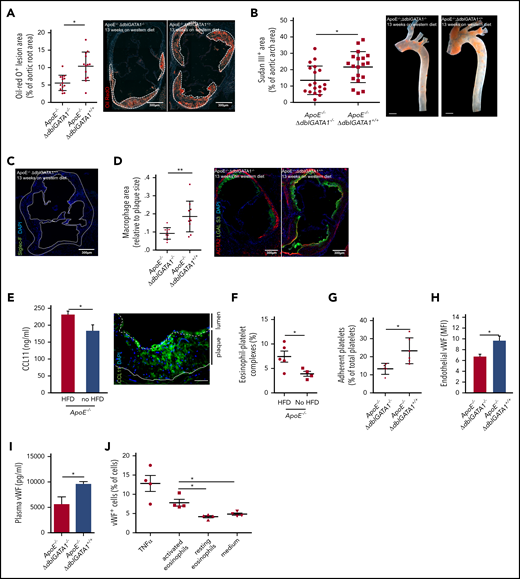 Eosinophils promote atherosclerotic plaque formation. (A) Atherosclerotic lesion formation (white dotted lines) assessed by lipid staining with Oil-Red O in the aortic root of eosinophil-deficient ApoE−/−;ΔdblGATA1−/− mice (n = 14: 7 female, 7 male) compared with littermate controls (ApoE−/−;ΔdblGATA+/+ (n = 13: 6 female, 7 male) after 13 weeks on an HFD. (B) Quantification of macroscopic lesion formation by Sudan III staining in the aortic arch of ApoE−/−;ΔdblGATA1−/− mice (n = 19: 9 female, 10 male) compared with ApoE−/−;ΔdblGATA+/+ littermate controls (n = 19: 9 female, 10 male). Scale bar, 200 µm. (C) Eosinophils were absent in plaques (white dotted line) of ApoE−/−;ΔdblGATA+/+ mice as assessed by staining for Siglec-F (green), nuclei are stained with 4′,6-diamidino-2-phenylindole (DAPI, blue). Image representative of 3 experiments. (D) ApoE−/−;ΔdblGata+/+ mice (n = 10) showed enlarged areas of macrophages (green) relative to plaque area as well as areas of smooth muscle cells (red) compared with the ApoE−/−;ΔdblGATA1−/− mice (n = 9). (E) Left: Elevated CCL11 serum levels in ApoE−/− mice in response to 12 weeks on an HFD compared with a chow diet (n = 5 each). Right: Representative staining for CCL11 (green) and DAPI (nuclei in blue) in the aortic root of ApoE−/− mice after 12 weeks on an HFD. Dotted line indicates endothelium; solid line indicates internal elastic lamina. Scale bar, 50 µm. (F) Formation of eosinophil-platelet aggregates given as CD41+Siglec-F+ eosinophils of all eosinophils assessed by FACS (n = 5 with an HFD; n = 4 with a chow diet) in ApoE−/− mice after 12 weeks. (G) Platelets of ApoE−/−;ΔdblGATA1−/− mice (n = 5) adhered less often at the uninjured endothelium of the carotid artery under steady-state conditions compared with platelets of ApoE−/−;ΔdblGATA1+/+ mice (n = 6) as assessed by intravital microscopy. (H) Exposure of VWF on the endothelial surface of the intact carotid artery quantified by immunohistology in ApoE−/−;ΔdblGATA1−/− (n = 16) and ApoE−/−;ΔdblGATA1+/+ (n = 13) littermates after 13 weeks on an HFD. (I) Plasma levels of VWF in ApoE−/−;ΔdblGATA1−/− and ApoE−/−;ΔdblGATA1+/+ (n = 5 each) littermates after 13 weeks on an HFD. (J) Endothelial cells exposed VWF in response to supernatant of eosinophils activated with IL-5 and CCL11 compared with supernatant from resting eosinophils or medium with IL-5 and CCL11 (n = 4 each). Tumor necrosis factor α (TNF-α) was used as a positive control. For panels A-B and D-J, data are mean ± standard deviation (SD). *P < .05; **P < .01.