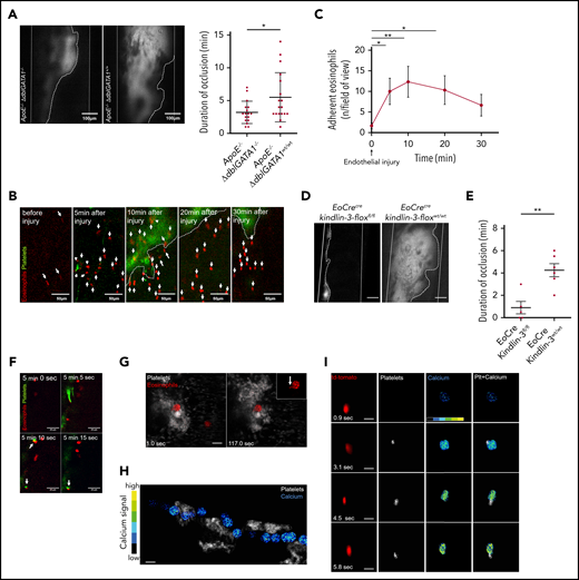 Eosinophil recruitment and platelet-induced activation in thrombosis. (A) Representative images of thrombus formation (marked by dotted line) in the carotid artery (marked by solid white lines) of an ApoE−/−;ΔdblGATA1−/− and an ApoE−/−;ΔdblGATA1+/+ mouse. In ApoE−/−;ΔdblGATA1−/− mice (n = 17), thrombus stability was significantly reduced compared with that of ApoE−/−;ΔdblGATA1+/+ littermate controls (n = 17), as shown by occlusion time. (B) Eosinophils (red, arrows) in EoCre;PC-G5-tdTfl/fl mice adhere immediately after initial endothelial injury at the lesion site of the carotid artery after FeCl3 application. Platelets labeled with fluorescent 2′,7′-dichlorofluorescein (green); thrombus shown by dotted line. (C) Quantification of eosinophil recruitment in vivo after FeCl3 application on the carotid artery (n = 3). (D) Representative images of thrombus formation 20 minutes after endothelial injury by FeCl3 in the carotid artery of EoCre;Kindlin-3fl/fl and EoCre;Kindlin-3wt/wt mice (thrombus area marked by dotted white line; carotid artery marked by solid white lines). Scale bar, 100 µm. (E) EoCre;Kindlin-3fl/fl mice (n = 5) had drastically reduced thrombus formation compared with that of wild-type littermates (n = 6). (F) During thrombus formation in the carotid artery, platelets (green) interacted with an eosinophil (red), which already adhered to the endothelium. Interacting cells are marked with arrows. (G) Eosinophils (red) in EoCre;PC-G5-tdTflox mice collect platelets (white) around themselves and form elongated processes (arrow in higher magnification, top right inset). Thrombosis induced by FeCl3 in the mesenteric microcirculation; images acquired by confocal microscopy. Scale bar, 20 µm. Images representative of 3 experiments. (H) Calcium signal (pseudocolored; blue/green, low signal; yellow/red, high signal) in an eosinophil interacting with several platelet aggregates (white) in the mesenteric microcirculation. Cropped images from intravital confocal microscopy in EoCre;PC-G5-tdTflox mice. Image representative of 3 experiments. (I) Calcium signal (pseudocolored) in an eosinophil (red) adhering to the endothelium before and during platelet contact (white). Image representative of 4 experiments. Cropped images from intravital epifluorescence microscopy in the carotid artery of EoCre;PC-G5-tdTflox mice after FeCl3 application. Scale bar, 20 µm. Representative of 4 experiments. For panels A-C and E, data are mean ± SD. *P < .05; **P < .01.