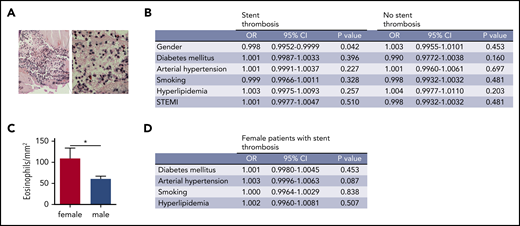 Eosinophil numbers in thrombi from patients with myocardial infarction. (A) Representative image of a Luna staining of a human coronary artery thrombus. Left: overview image. Original magnification ×20. Right: higher magnification (original magnification ×40) showing eosinophils (arrowheads) with polylobulated nuclei (dark blue) and eosinophil granules (bright red). Scale bar, 75 µm. (B) Logistic regression analysis of eosinophil numbers in coronary artery thrombi divided by type of thrombosis (ST vs native vessel thrombosis) according to gender, diabetes mellitus, arterial hypertension, smoking status, hyperlipidemia, or presentation as ST-elevation myocardial infarction. (C) Eosinophils/mm2 in human coronary artery thrombi from male (n = 168) and female patients (n = 48) with ST. (D) Logistic regression analysis of eosinophil numbers in coronary artery thrombi from female patients with ST according to diabetes mellitus, arterial hypertension, smoking status, and hyperlipidemia. CI, confidence interval; OR, odds ratio.
