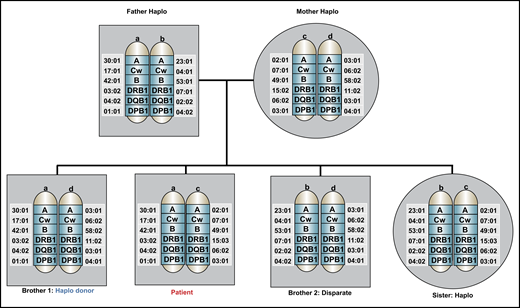 Family pedigree of the patient in the clinical case. An HLA-haploidentical donor has inherited one HLA haplotype in common with the recipient and is mismatched for anywhere between 0 and 5 HLA genes on the unshared haplotype. Biological parents and biological children always share an HLA haplotype with the recipient, unless a rare genetic rearrangement has occurred. In this pedigree analysis, the patient has 3 siblings, none of whom are HLA-matched, but 2 are partially matched related (haploidentical) donors, whereas 1 brother is disparate. Other potential HLA-haploidentical donors include half-siblings, aunts, uncles, nieces, nephews, cousins, or grandchildren.