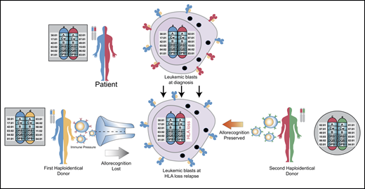 Rationale for using an alternative donor for second allogeneic transplantation. The patient’s 2 HLA haplotypes are shown in blue and red. The first donor shares a common blue haplotype with the recipient and a distinct yellow haplotype. At relapse, the leukemic blasts lose the mismatched red haplotype, which results in loss of cell surface expression of that mismatched HLA molecule. After relapse and subsequent chemotherapy to induce a remission, a second haploidentical donor is selected because they share the red haplotype with the patient, but lack the blue haplotype. This will allow the second donor’s immune system to recognize these disparate HLA molecules on the leukemic blasts to potentially elicit graft-versus-leukemic effects. Figure concept was influenced by two prior publications.8,73