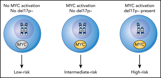 Model for the subsets of B-PLL based on their genetic parameters and linked to clinical outcome of overall survival. Using the presence or absence of MYC activation and del17p− status, 3 subsets of B-PLL can be discerned. Thus, for leukemic cells characterized with the following possibilities: with no MYC activation and no del17P− (ie, low risk), leukemic cells with MYC activation and no del17P− (ie, intermediate risk), and for leukemic cells with both MYC activation and del17P− (ie, high risk) there exists a hierarchy for overall survival.