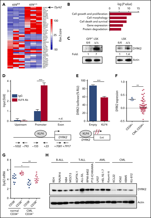 The kinase DYRK2 is repressed by KLF4 in leukemia stem/progenitor cells. (A) Gene expression heat map showing the most deregulated genes comparing GFP+ LSK cells purified from Klf4fl/fl and Klf4Δ/Δ CML mice. (B) Gene ontology analysis of deregulated cellular pathways using Ingenuity Pathway Analysis. (C) Immunoblot analysis of DYRK2 protein expression in purified GFP+ LSK cells (leukemia stem/progenitor cells) from the bone marrow of CML mice and LSK cells (hematopoietic stem/progenitor cells). Densitometry values were used to estimate the fold increase compared with wild-type using values normalized to actin. (D) Analysis of KLF4 occupancy at the DYRK2 promoter in lineage-negative bone marrow cells from CML mice by ChIP-PCR analysis. Genomic DNA was immunoprecipitated with anti-KLF4 antibody (KLF4 Ab) or IgG control and amplified with primers spanning the DYRK2 promoter, upstream, and exon sequences. (E) Promoter assay using a KLF4 expression plasmid and Dyrk2-luciferase reporter construct in the 293T cell line. (F) Analysis of DYRK2 messenger RNA levels in CD34+ cells from healthy individuals and CML patients in the chronic phase using a published data set (GSE4170). (G) DYRK2 qPCR in CD34+ CD38− (stem) and CD34+ CD38+ (progenitor) cells purified from CML patients and healthy donors. (H) Immunoblot analysis of DYRK2 expression in a panel of lymphoid and myeloid leukemia cell lines. *P < .05, **P < .01, ***P < .001, 2-tailed Student t test (D-E), Mann-Whitney U test (F-G). n.d., not detected.