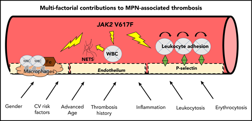 Multifactorial contributions to MPN-associated thrombosis. ASA, acetylsalicylic acid; WBC, white blood cells. Figure concept adapted in part from Setiadi et al.87