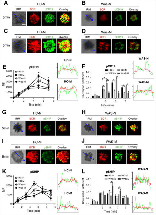 The recruitment of pCD19 was decreased in WAS memory B cells, but the recruitment of phosphorylated SHIP (pSHIP) was increased in WAS memory B cells. (A-D) TIRFM and IRM analysis of pCD19 staining in the contact zone of HCs and WAS (P1-12) memory and naive B cells incubated with membrane-tethered Fab′–anti-Ig. The colocalization coefficients between BCR and pCD19 staining were determined using NIS-Elements AR 3.2 (F). Shown are representative images (A-D) and the average MFI (E) or colocalization coefficients (F) (±SD) from ∼50 individual cells of 3 independent experiments. (G-J) TIRFM and IRM analysis of pSHIP staining in the contact zone of HCs and WAS (P1-12) naive and memory B cells incubated with membrane-tethered Fab′–anti-Ig. Shown are representative images (G-J) and the MFI (±SD) of pSHIP (K) in the B-cell contact zone from 3 independent experiments. TIRFM analysis of the spatial relationship of BCR with pSHIP (G-J) in the contact zone of B cells incubated with membrane-tethered Fab′–anti-Ig. The colocalization coefficients between BCR and pSHIP staining were determined using NIS-Elements AR 3.2 software (L). Bars, 2.5 μm. *P < .01, compared with WAS naive or memory B cells.