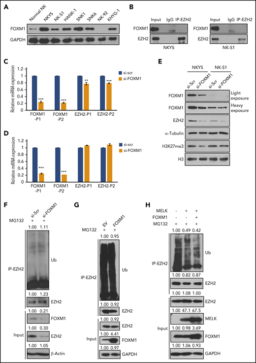 FOXM1 may not be an upstream mediator of EZH2 ubiquitination. (A) Expression level of FOXM1 in normal NK and NKTL cell lines. (B) IP showing absence of interaction between EZH2 and FOXM1 in NKYS and NK-S1. (C-D) Quantitative reverse transcription PCR assay in (C) NKYS or (D) NK-S1 cells upon FOXM1 knock-down. Data are shown as mean ± SD, N = 3. *P < .05; **P < .01; ***P < .001. NKTL cells were harvested for RNA extraction 48 hours after transfection. (E) Immunoblots of indicated proteins upon FOXM1 knock-down in NKYS and NK-S1 cells. NKTL cells were harvested for immunoblots 48 hours after transfection. (F) Level of EZH2 ubiquitination upon knock-down of FOXM1 in NKYS cells. MG132 was given at 1 µM for 6 hours of treatment 48 hours after transfection. (G-H) Level of EZH2 ubiquitination upon overexpression of indicated proteins in HEK293T cells. MG132 was given at 10 µM for 6 hours of treatment 48 hours after transfection. (F-H) Densitometry analysis was used to quantify average changes in 3 individual experiments. All immunoblots were performed in at least 3 individual experiments and representative images are shown. SD, standard deviation.
