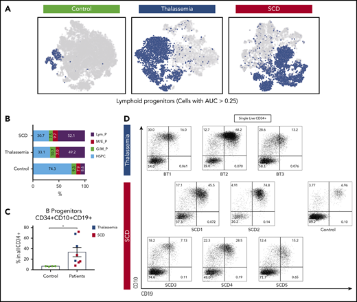 Marked expansion of lymphoid-primed progenitors in the bone marrow CD34+ cells of children with SCDs and thalassemia. (A) Dimensionality reduction using t-distributed stochastic neighbor embedding (t-SNE) on pooled data from 4 controls (n = 29 086), 3 thalassemia (n = 11 034), and 5 SCD patients (n = 11 776); cells identified distinct cell populations while preserving intercluster relationships. Cell type was annotated based on the expression of reported marker genes using AUcell (see supplemental Table 3). (B) Components of cell types identified in single-cell sequencing data: lymphoid progenitors (Lym_P), megakaryocyte/erythroid progenitors (M/E_P), granulocyte/monocyte progenitors (G/M_P), and HSPCs. (C) Quantification of B-progenitor cells by flow cytometry in healthy donors and patients (SCD in red and thalassemia in blue). (D) Multiparameter flow cytometry plots showing the expansion of CD10+CD19+ cells in CD34+ cells derived from the bone marrow of patients with SCD and thalassemia. AUC, area under the curve.
