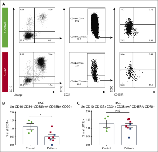 CD34-based HSPC estimation overestimates the HSC quantity in patients. (A) Flow plots show gating of Lin−CD10−CD34+CD38low\−CD45RA−CD90+ HSCs from a healthy donor and a child with SCD. (B) The proportion of phenotypic Lin−CD10−CD34+CD38low\−CD45RA−CD90+ HSCs in total CD34+ cells was reduced in patients (supplemental Figure 3B,D). This may be partially explained by the fact that she was the oldest and only postpubertal subject. (C) The proportion of phenotypic Lin−CD10−CD34+CD133+CD38low\−CD45RA−CD90+ HSCs in total CD133+ cells was not significantly different between patients and controls.