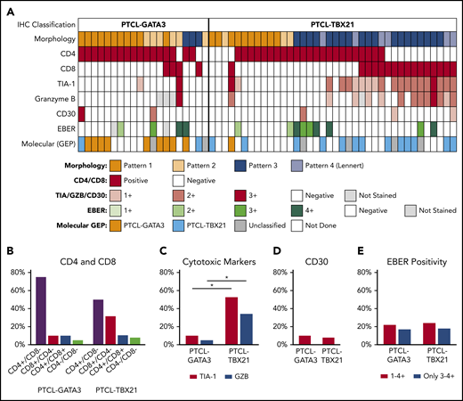 Association of morphologic patterns and additional immunophenotypic features in PTCL subtypes classified by the IHC algorithm. (A) Heatmap representation of the morphologic patterns (1-4) and CD4, CD8, TIA-1, granzyme B, and CD30 immunostain and EBER in situ hybridization positivity in PTCL subtypes in training and validation cohort studied on TMA (n = 57). Each case is represented by a column, with CD4/CD8 reported as positive and negative and cytotoxic markers/CD30 positivity graded as 0-3. EBERs was evaluated semiquantitatively calculating the average number of positive cells per field (f): 0/f = 0; <1/f = 1+; 1 to 9/f = 2+; 10 to 50/f = 3+; and >50/f = 4+. Distribution of (B) CD4 and CD8 single-positive, double-positive, or double-negative immunophenotype; (C) cytotoxic markers; (D) CD30; and (E) EBER in the 2 PTCL subtypes. *There is a significant association of cytotoxic marker expression with PTCL-TBX21 subtype (P < .001).