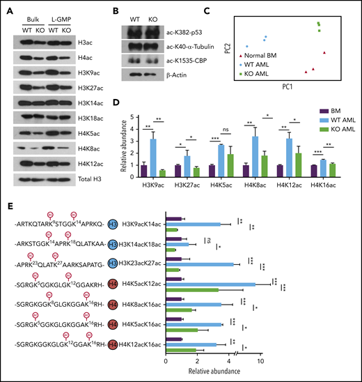 AMPK KO AML cells markedly downregulate histones that are acetylated on multiple lysine residues. (A-B) Immunoblotting with WT or AMPK KO bulk (GFP+) AML cells or the L-GMP population to detect acetylated histones (A) or acetylated p53, α-tubulin, or CBP (B). (C) Principal component analysis of the histone proteoform data set obtained from normal bone marrow (BM) cells, WT AML cells, and AMPK KO AML cells. (D) Acetylation status of individual lysine residues from the histone proteoform analysis, normalized against normal BM cells (n = 3). (E) The abundance of histone proteoforms that were acetylated on 2 lysine residues (n = 3). All data represent mean ± standard deviation. *P < .05; **P < .01; ***P < .001 by 1-way ANOVA.