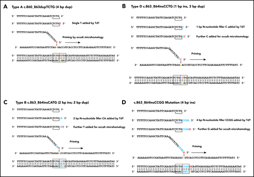 TdT/occult microhomology model for genesis of NPM1 mutations. (A) Type A mutation, single base of occult microhomology. (B) Type D mutation, 2 nucleotides added, the first visible as an N-nucleotide, the second used for occult microhomology. (C) Type B mutation, 3 nucleotides added, 2 visible as N-nucleotides. (D) c.863_864insCCGG mutation, 5 nucleotides added, 4 visible as N-nucleotides.