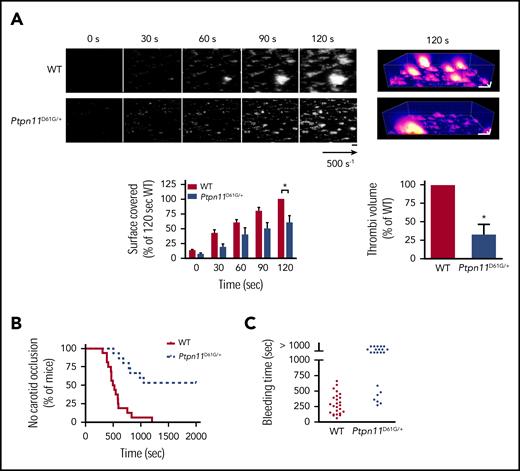Ex vivo and in vivo thrombus formation in Ptpn11D61G/+ mice. (A) Mouse heparinized whole blood, where platelets were labeled with DiOC6, was perfused through Cellix Vena8 Fluoro+ biochips at arterial physiological shear rate of 500 s−1 on fibrillar collagen matrix over 2 minutes. Thrombus formation was visualized in real time by videomicroscopy. Representative 2- and 3-dimensional images were respectively obtained after processing with ImageJ and Imaris software (scale bar, 20 μm). Surface covered by platelets and thrombus volume were quantified by using ImageJ software (mean ± sSEM; n = 4 mice of each genotype). (B) Time to blood flow cessation was measured with a transonic flow probe at the carotid artery of mice after exposure to 7% FeCl3 for 3 minutes. Graph represents the percentage of mice displaying no carotid occlusion. (C) Time required for the bleeding to stop after 3-mm tail-tip transection of anesthetized mice. Each point represents a mouse. *P < .05 vs WT according to 2-way ANOVA and 1-sample t test.
