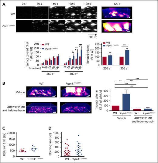 Ex vivo and in vivo thrombus formation in Ptpn11T468M/+ mice. (A) Heparinized whole blood from Ptpn11T468M/+ mice, where platelets were labeled with DiOC6, was perfused through Cellix Vena8 Fluoro+ biochips at arterial physiological shear rates of 250 s−1 and 500 s−1 on fibrillar collagen matrix during 2 minutes. Thrombus formation was visualized in real time by videomicroscopy. Representative 2- and 3-dimensional images were respectively obtained after processing with ImageJ and Imaris software (scale bar, 20 μm). Surface covered by platelets and thrombus volume were quantified by using ImageJ software (mean ± SEM; n = 6 mice of each genotype). (B) Heparinized whole blood from Ptpn11T468M/+ mice was treated or not with ARC69931MX (10 μM) and indomethacin (10 μM) over 30 minutes; platelets were labeled with DiOC6 and perfused through Cellix Vena8 Fluoro+ biochips at arterial physiological shear rate of 500 s−1 on fibrillar collagen matrix over 2 minutes. Representative 3-dimensional images were obtained after processing with Imaris software (scale bar, 20 μm) at 2 minutes of perfusion. At the end of the perfusion, thrombus volume was quantified by using ImageJ software (mean ± SEM; n = 6 mice of each genotype). (C) Time to blood flow cessation (occlusion time) was measured with a transonic flow probe at the carotid artery of mice after exposure to 7% FeCl3 for 3 minutes. Each point represents a mouse. (D) Time required for the bleeding to stop after 3-mm tail-tip transection of anesthetized mice. Each point represents a mouse. *P < .05, **P < .01, ***P < .001 according to 2-way ANOVA and 1-sample t test.