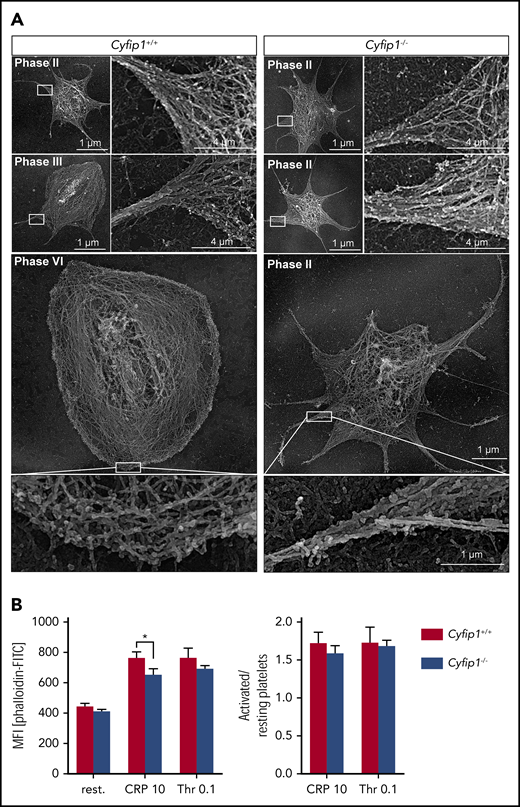 Cyfip1-deficient platelets cannot form branched actin filaments. (A) Platinum replica electron microscopic images of the cytoskeleton ultrastructure of platelets spread on fibrinogen after 15 minutes. Scale bars, 1 or 4 µm. (B) Left, F-actin content under resting conditions and upon stimulation with CRP (10 μg/ml) or thrombin (0.1 U/ml) was assessed by measuring the MFI of bound FITC-labeled phalloidin in flow cytometry. Right, Ratio of MFI of activated vs resting samples reflecting F-actin polymerization rates (n = 4, representative for 3 independent experiments). Values are mean plus or minus SD. *P < .05.
