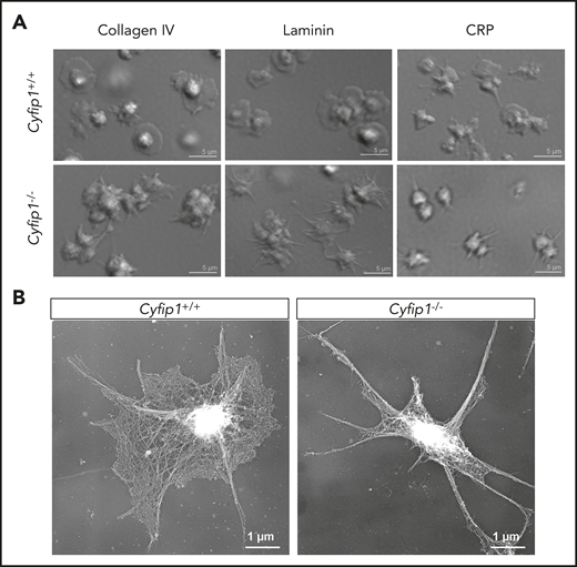 Abolished lamellipodium formation of mutant platelets on different matrices. (A) Washed platelets were allowed to spread on collagen IV, laminin, or CRP for 30 minutes (n = 3). Scale bars, 5 µm. (B) Images of the platelet cytoskeleton ultrastructure on CRP after 15 minutes (n = 5). Scale bars, 1 µm.