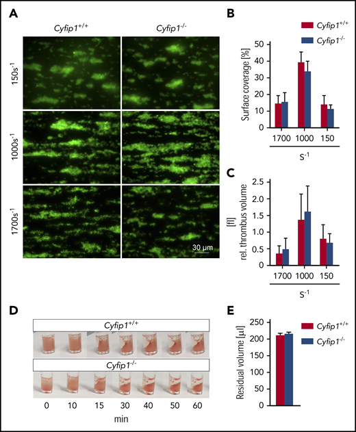 Normal ex vivo thrombus formation and clot retraction of Cyfip1-deficient platelets. (A) Thrombus formation was assessed on collagen at different shear rates. Shown are representative fluorescence pictures of platelets stained with a Dylight-488 anti-GPIX antibody (n = 5, representative for 3 independent experiments). Scale bar, 30 µm. (B) Surface coverage and (C) relative thrombus volume were quantified. (D) Clot formation was observed over time and (E) residual serum volume was measured (n = 3, representative for 2 independent experiments).