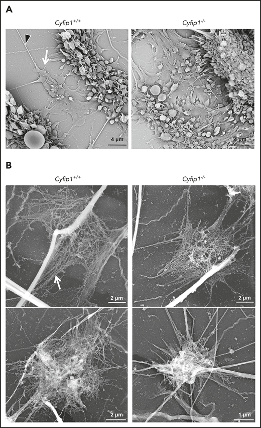 Flattened platelets with filopodium-like structures at the bottom of the thrombus. (A) Scanning electron microscopic image of platelets after experimentally induced ex vivo thrombus formation on collagen. White arrow indicates a filopodium; black arrowhead indicates collagen fiber. Scale bar, 4 µm. (B) Platinum replica of platelets after experimentally induced ex vivo thrombus formation on collagen. White arrow indicates a filopodium with unbranched actin filaments. Scale bars, 1 and 2 µm.
