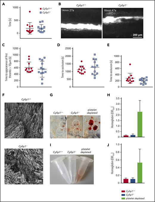 Lamellipodium formation is not required for hemostatic function and arterial thrombus formation. (A) A 2-mm segment of the tail tip was cut, and bleeding was determined to have ceased when no blood drop was observed on the filter paper. Each symbol represents 1 individual. (B) Mesenteric arterioles were treated with 20% FeCl3, and adhesion and thrombus formation of fluorescently labeled platelets were monitored by in vivo fluorescence microscopy. Representative images are shown. (C) Statistical evaluation of the time to appearance of a first thrombus and (D) time to occlusion. (E) The abdominal aorta was mechanically injured using forceps (compression for 15 seconds), and blood flow was monitored. Each symbol represents 1 individual. (F) Scanning electron microscopy of an in vivo formed thrombus (n = 4). Scale bar, 2 µm. (G-H) Mice were subjected to the rpA reaction to induce local skin inflammation. (G) Representative images are shown. Inflammatory spots are highlighted. Original image: 4 × 3 cm. (H) Hemoglobin (Hb) content in tissue punch biopsies from inflammatory spots was quantified (n = 4, representative for 3 independent experiments). (I) Representative images of bronchoalveolar lavage liquid at 4 hours after LPS application. (J) Quantification of the Hb content in bronchoalveolar lavage liquid. Platelet-depleted animals served as positive control of inflammatory bleeding in both models (n = 5, representative for 3 independent experiments).