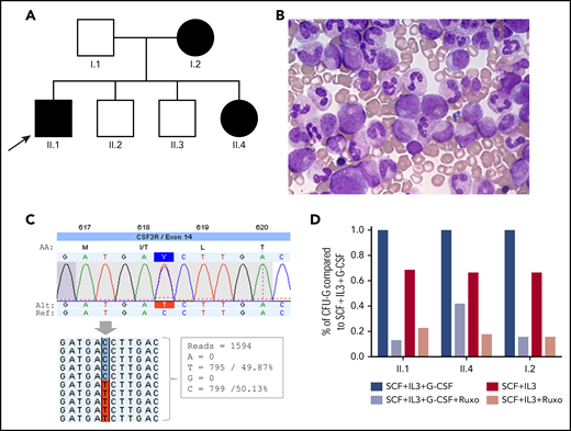 Germline CSF3R c.1853C>T:p.T618I mutation. (A) Family tree. Arrow indicates the proband. Individuals with CNL and germline T618I mutation are marked in black. (B) BM aspirate in individual II.1 showing granulocytic hyperplasia. (C) Schematic of the CSF3R T618I mutation identified by HTS. Reads carrying the wild-type nucleotide (n = 799) and the variant nucleotide (n = 795) are shown (screenshot from JSI Medical System software). (D) Clonogenic assay. CD34+ progenitors (n = 1000) were seeded in methylcellulose in SCF + IL-3 ± G-CSF ± ruxolitinib; CFU-G colonies were counted 14 days later. The results are the means ± SD of 1 representative experiment performed in triplicate. IL-3, interleukin-3; SCF, stem cell factor.